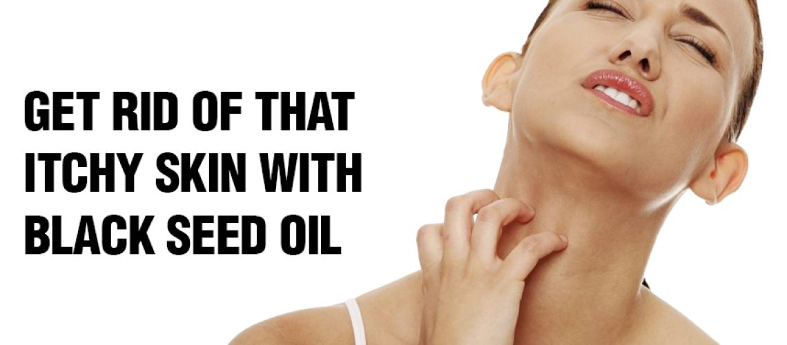 Get-Rid-of-That-Itchy-Skin-With-Black-Seed-Oil